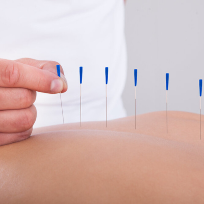 Acupuncture helps in pregnancy